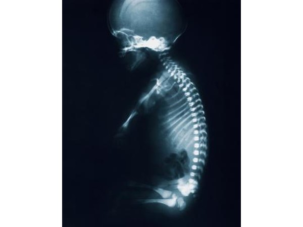 A healthy spine should have a slight "S" curve.