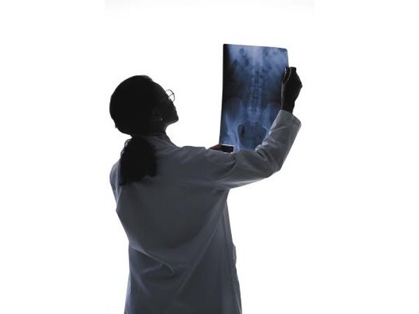 Doctor reading xray