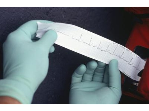 Nurse reading EKG results