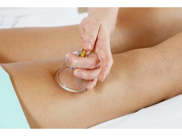 Cellulite vacuum.