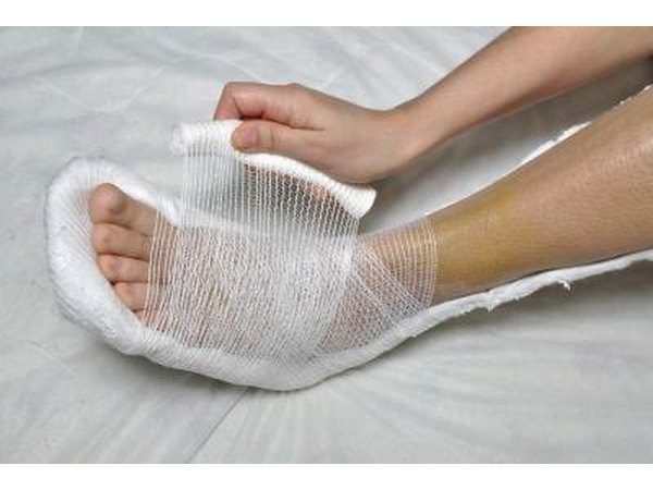 Keep your cast dry.