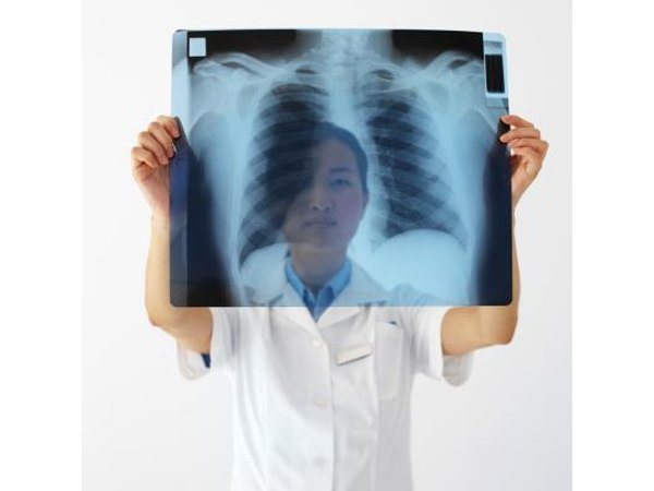 Doctor examining x-ray of lungs.