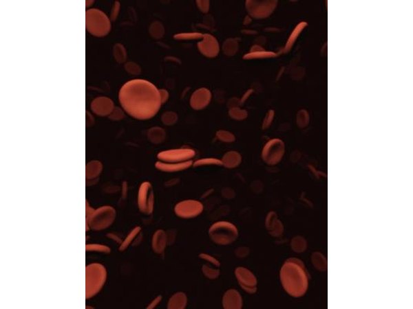 Anemia is a low red blood cell count