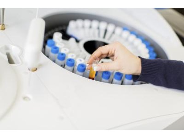 Autoimmune diseases can cause a high RF lab result.