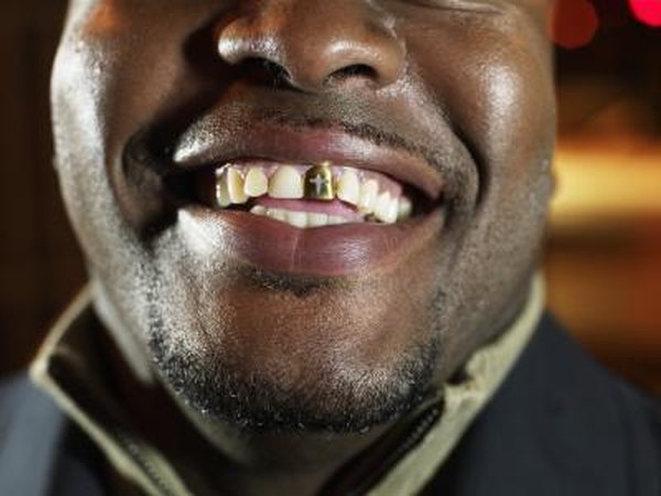 Missing tooth