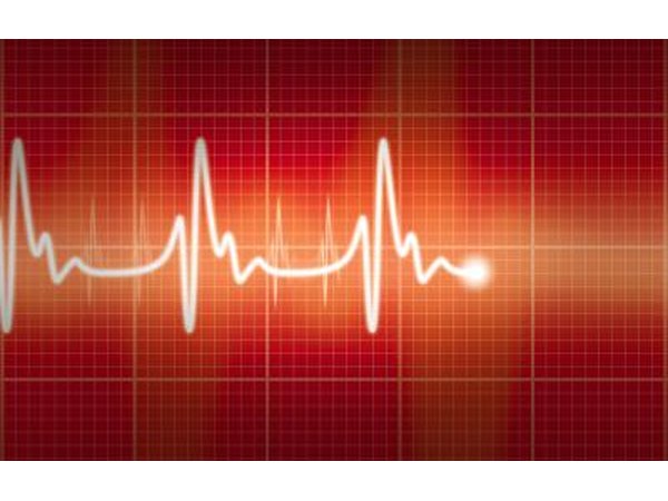 EKG.