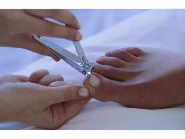 Nail fungus can be spread through the use of a shared toenail clipper.