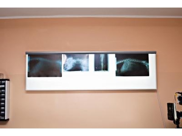X-ray's may detect tumors.