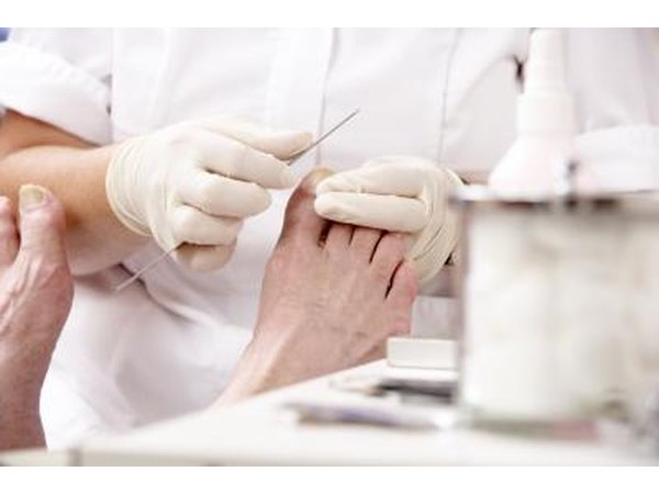During tendon release the tendon is cut.