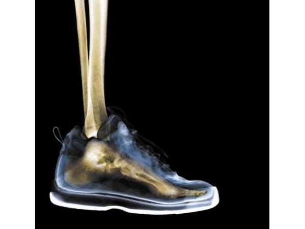 Shoe x-ray
