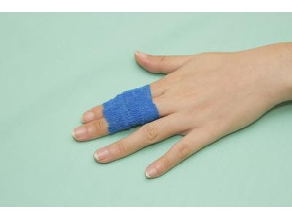 A broken finger may be crooked.