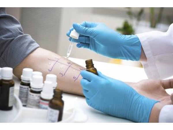 Skin test for allergies.