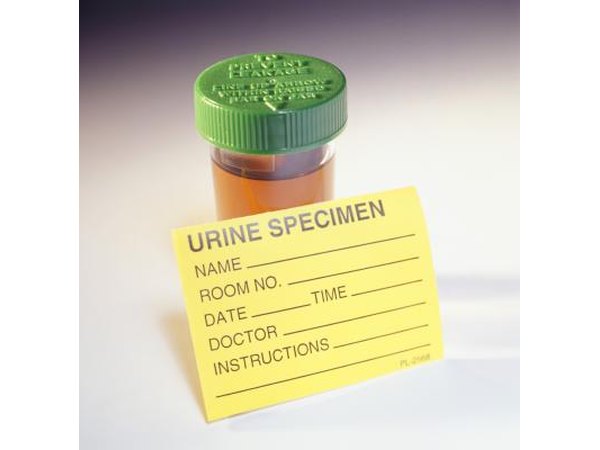 A simple urine test usually finds excess ketones first.