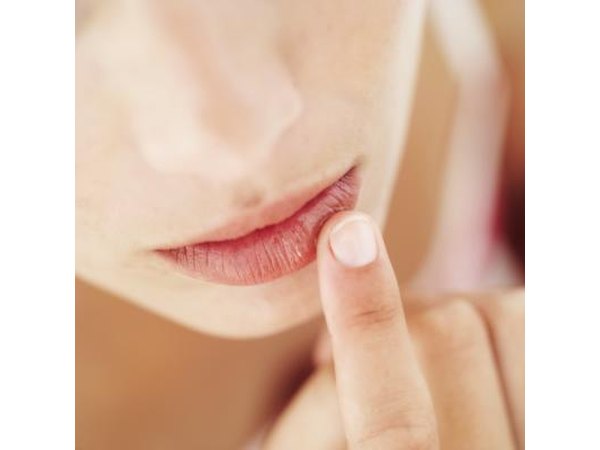 Woman applying ointment