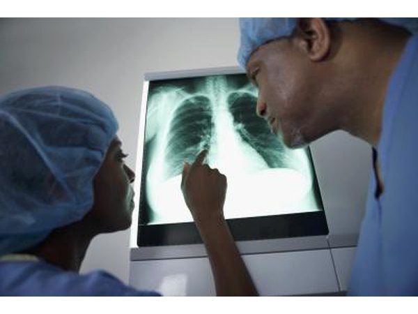Doctors looking at x-ray of lungs