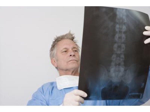 Doctors can spot hemangiomas in x-rays.