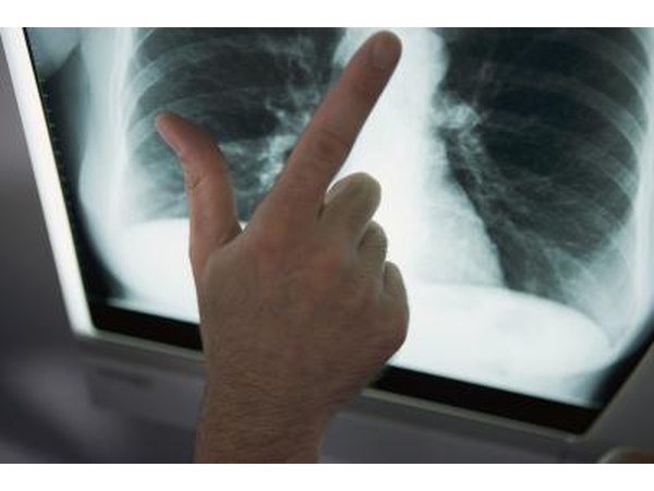 Phlegm occurs when there is an infection in your lungs.