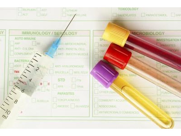 Health results and samples.