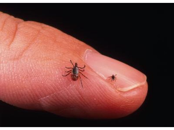 Deer ticks, one adult and one nymph, on a man's finger. Infected deer ticks transmit Lyme Disease to humans.