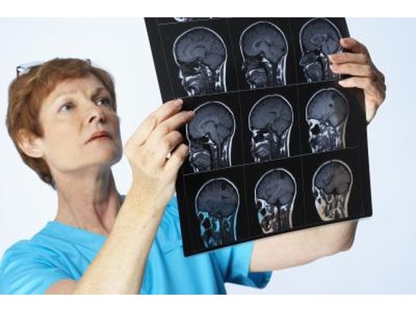 Doctor looking at MRI.