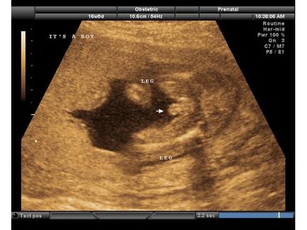 Congenital conditions may occur to a developing fetus.