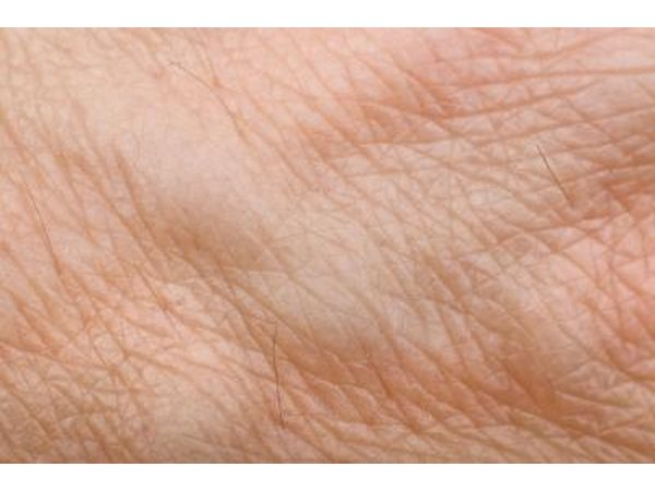Human veins close up.