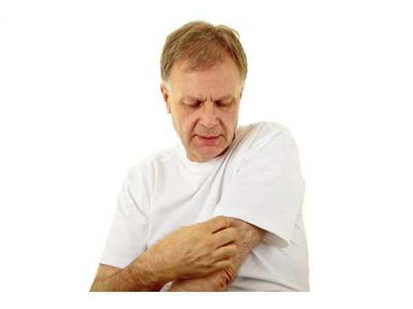 Sensitive skin.