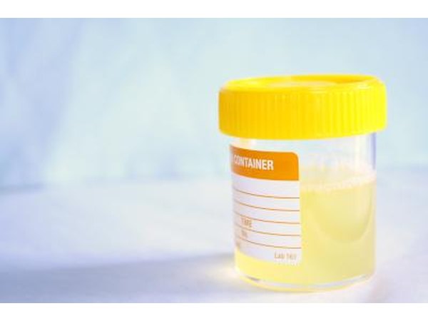 Urine in cup.