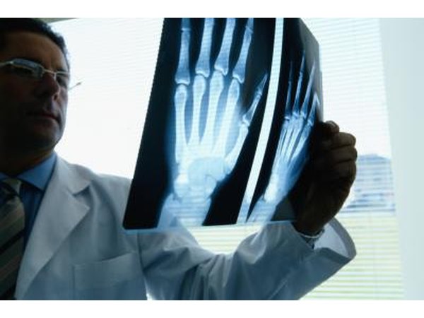 Doctor looking at hand xray
