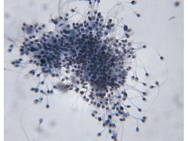 Microscopic image of Sperm