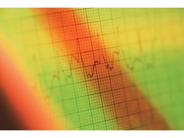 vagal maneuvers will temporarily reduce your heart rate
