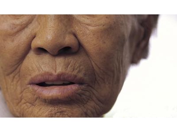 Malignant melanoma may be a side effect