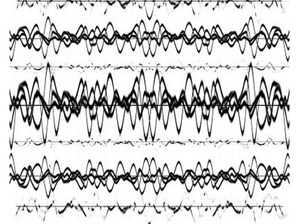 Brain wave.
