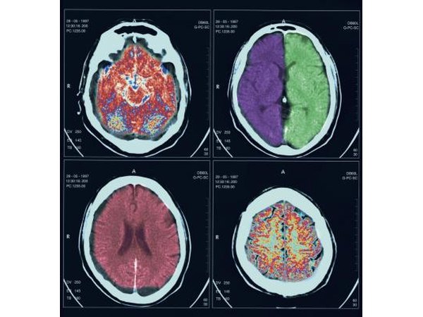 Scanned images of the human brain.