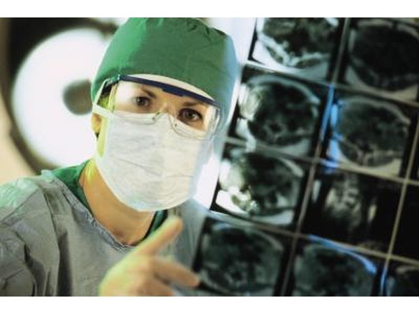 Doctor looking at brain scan