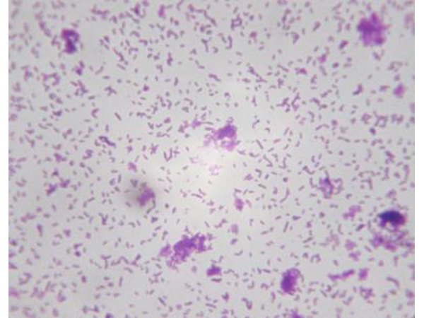 Microscopic view of bacteria.