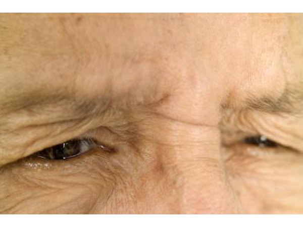 Vision problems are a common symptom