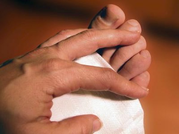 The toe nails may be thick and have deposits of corn-like material under them.