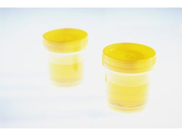 Urine sample