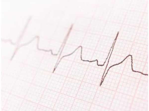 EKG results