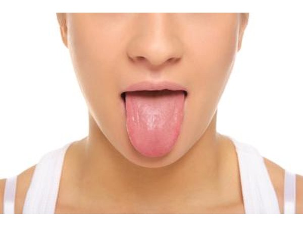 Bumps or membranes on tongue are a symptom.
