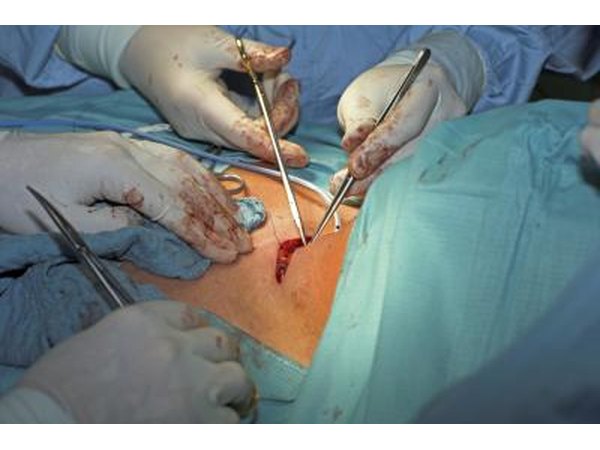 Surgery is the most common type of treatment for thyroid cancer.