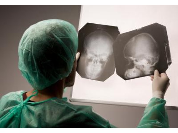 Doctor looking at x-ray.