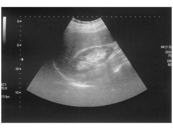 Doctors test for problems with the gallbladder through blood and imaging tests, such as an ultrasound or CT scan.