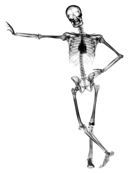 Anatomy: The Parts of Bones | Education - Seattle PI