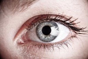 What causes fatty deposits in the eye?