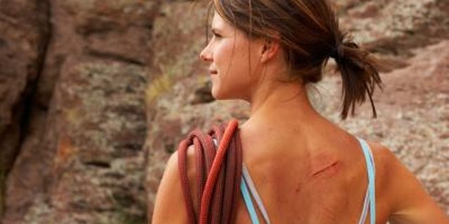Jupiterimages/Photos.com/Getty Images Reducing scar visibility maintains overall skin beauty.