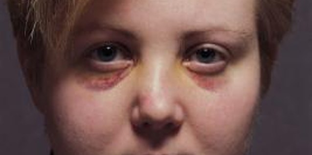Comstock/Comstock/Getty Images Abused people need to talk at their own pace.