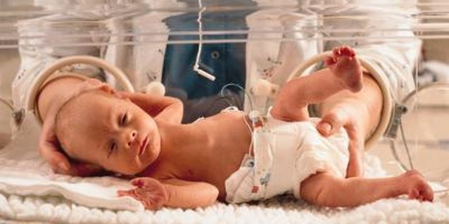 Photodisc/Photodisc/Getty Images Premature babies face different issues than babies who don't gain weight after birth.
