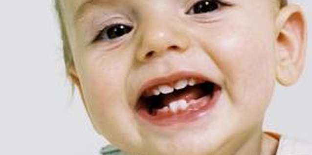 BananaStock/BananaStock/Getty Images Oral-motor difficulties are common causes of pronunciation problems.